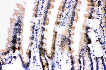 Ubiquitin/UBB Rabbit Polyclonal Antibody