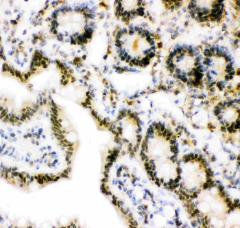 Ubiquitin/UBB Rabbit Polyclonal Antibody