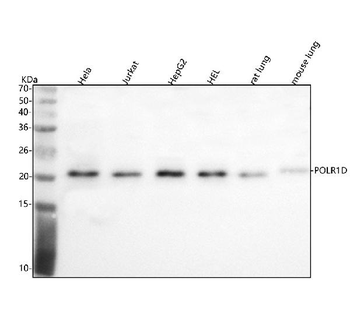 POLR1D Rabbit Polyclonal Antibody