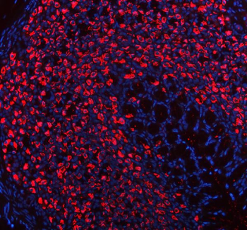 ATP4B Rabbit Polyclonal Antibody