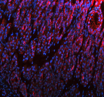 E-cadherin/Cdh1 Rabbit Polyclonal Antibody
