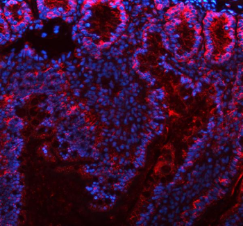 E-cadherin/Cdh1 Rabbit Polyclonal Antibody