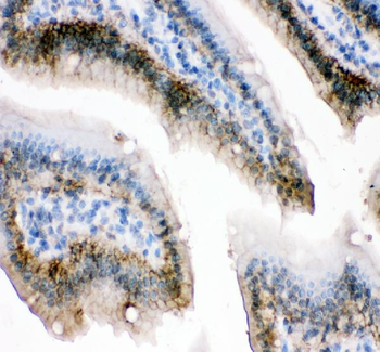 E-cadherin/Cdh1 Rabbit Polyclonal Antibody