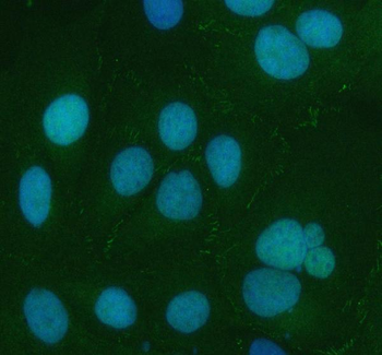 CXADR Rabbit Polyclonal Antibody