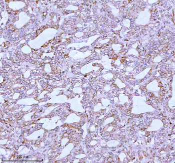 ME3 Rabbit Polyclonal Antibody