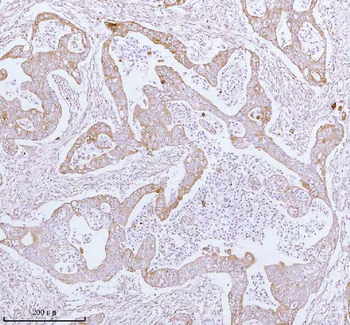 ME3 Rabbit Polyclonal Antibody