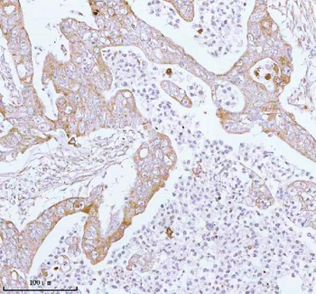 ME3 Rabbit Polyclonal Antibody