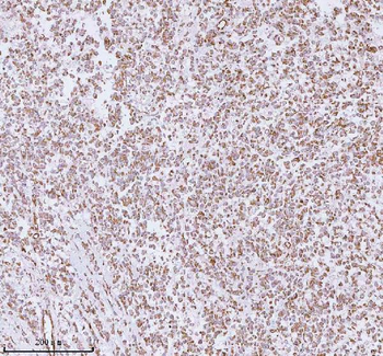 ME3 Rabbit Polyclonal Antibody