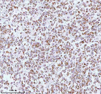 ME3 Rabbit Polyclonal Antibody