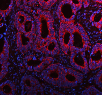 ME3 Rabbit Polyclonal Antibody