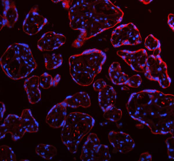 ME3 Rabbit Polyclonal Antibody