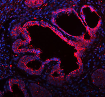 ME3 Rabbit Polyclonal Antibody