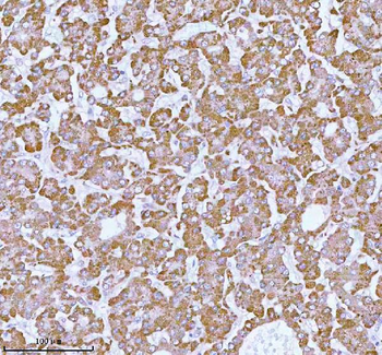 ME3 Rabbit Polyclonal Antibody