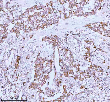 ME3 Rabbit Polyclonal Antibody