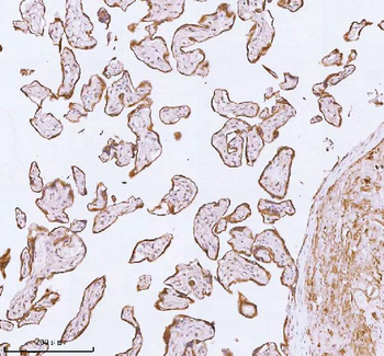 ME3 Rabbit Polyclonal Antibody