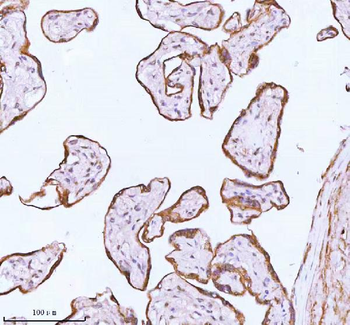 ME3 Rabbit Polyclonal Antibody