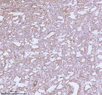 ME3 Rabbit Polyclonal Antibody