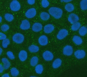 XRN1 Rabbit Polyclonal Antibody