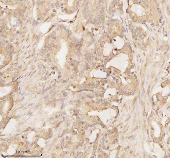 ARHGEF7 Rabbit Polyclonal Antibody