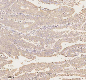 ARHGEF7 Rabbit Polyclonal Antibody