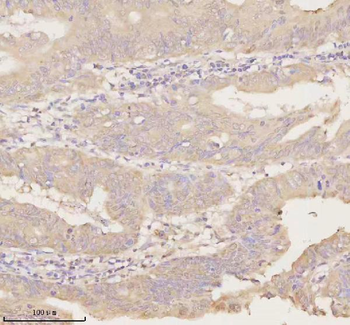 ARHGEF7 Rabbit Polyclonal Antibody