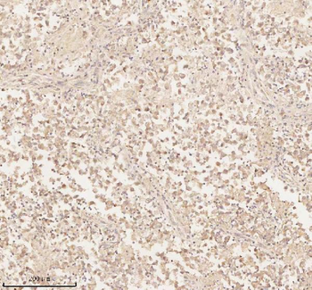 ARHGEF7 Rabbit Polyclonal Antibody