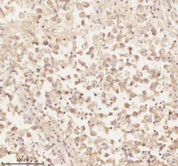 ARHGEF7 Rabbit Polyclonal Antibody