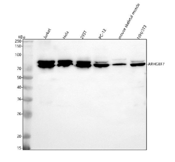 ARHGEF7 Rabbit Polyclonal Antibody
