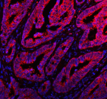 ARHGEF7 Rabbit Polyclonal Antibody