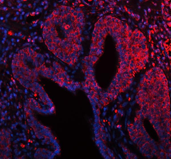 ARHGEF7 Rabbit Polyclonal Antibody