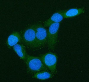 ARHGEF7 Rabbit Polyclonal Antibody