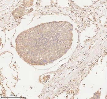 ARHGEF7 Rabbit Polyclonal Antibody