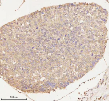 ARHGEF7 Rabbit Polyclonal Antibody