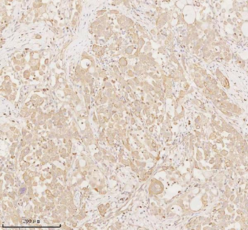 ARHGEF7 Rabbit Polyclonal Antibody