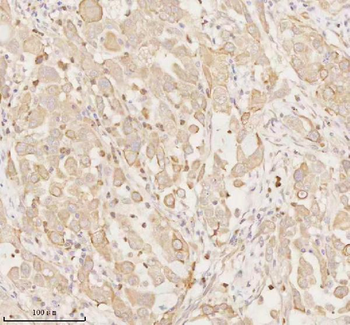 ARHGEF7 Rabbit Polyclonal Antibody