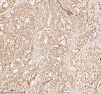 ARHGEF7 Rabbit Polyclonal Antibody