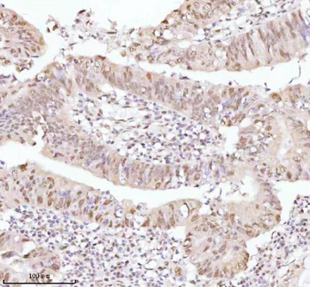 ASH2L Rabbit Polyclonal Antibody