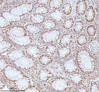 ASH2L Rabbit Polyclonal Antibody