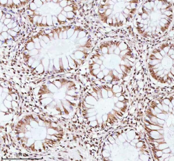 ASH2L Rabbit Polyclonal Antibody