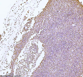 ASH2L Rabbit Polyclonal Antibody