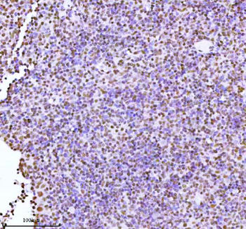 ASH2L Rabbit Polyclonal Antibody