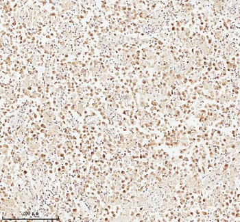 ASH2L Rabbit Polyclonal Antibody