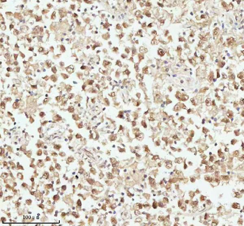 ASH2L Rabbit Polyclonal Antibody