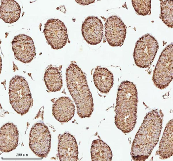 ASH2L Rabbit Polyclonal Antibody