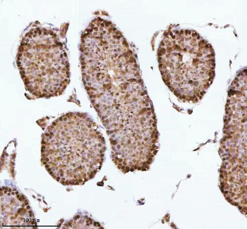 ASH2L Rabbit Polyclonal Antibody