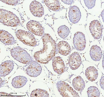 ASH2L Rabbit Polyclonal Antibody