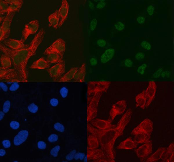 ASH2L Rabbit Polyclonal Antibody