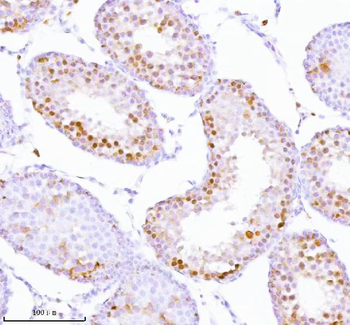ASH2L Rabbit Polyclonal Antibody