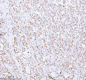ASH2L Rabbit Polyclonal Antibody