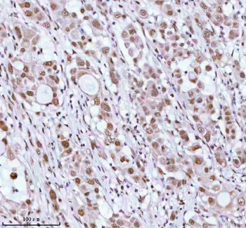 ASH2L Rabbit Polyclonal Antibody